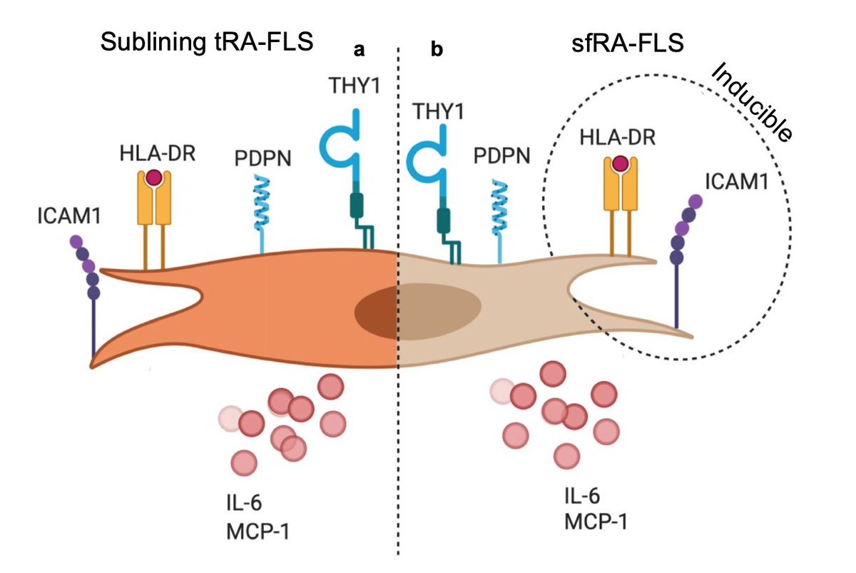 KragstrupTW's tweet photo. Phenotypic and functional characterization of synovial fluid-derived fibroblast.

Synovial fluid-derived FLS are very similar to sublining tissue FLS in patients with RA.

Well done @Morten__Aagaard, @Lomhol1, and team.

https://t.co/2WoH32ujli https://t.co/eHP5JuUW4w