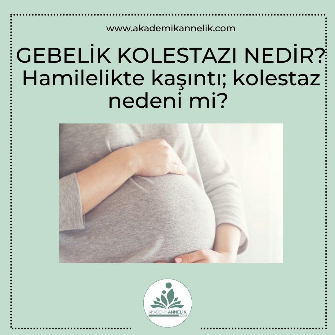 Gebelik kolestazı; sadece gebelik döneminde görülen vücuttaki safra yollarının işlevindeki bozukluk nedeniyle kanda safra asiti birikimidir.

Bilgi için: akademikannelik.com/Hamilelik-Deta…

#kolestaz #gebelik #pregnancy #hamilelik #kaşıntı #hamileliktestleri #tarama #haftahaftahamilelik