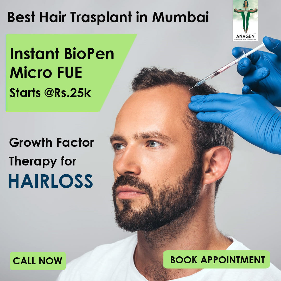 Anagen Hair Transplant Clinic on Twitter: Anagen Hair Transplant Clinic on Twitter: