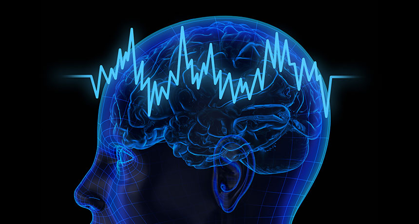 MassGeneralNeuroscience (@mghneurosci) on Twitter photo Sahar Zafar, MD, and collaborators across <a href="/MGHNeurology/">MGH Neurology</a>, have created a convolutional neural network—a form of AI in which a computer system learns to recognize patterns in visual data—that efficiently labels huge volumes of continuous EEG data @MGH_RI advances.massgeneral.org/neuro/journal.… Sahar Zafar, MD, and collaborators across <a href="/MGHNeurology/">MGH Neurology</a>, have created a convolutional neural network—a form of AI in which a computer system learns to recognize patterns in visual data—that efficiently labels huge volumes of continuous EEG data @MGH_RI advances.massgeneral.org/neuro/journal.…