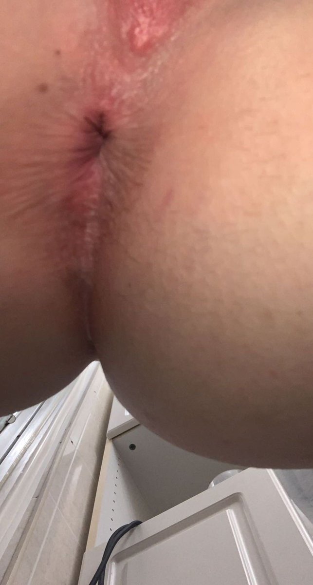 transguyxxx's tweet photo. https://t.co/zSLoqQk5xb
Go sub to see more content like this &amp; videos. Any suggestions ? https://t.co/oAQBSYCXsQ