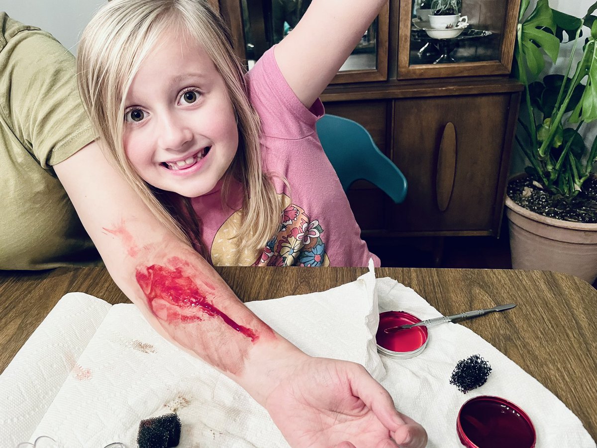 midwestfilmbuff's tweet image. Sweet! I started practicing cuts and wounds w/ a cheap Halloween makeup kit I found…
Effort 1: Epic fail. I blame the paint (no purple for bruising). But I digress.
Effort 2: I gave Piper a Giallo glass wound.
Effort 3: I gave Jude a hot poker wound.
I’m obsessed. #mutantfan