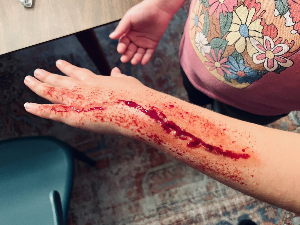 midwestfilmbuff's tweet image. Sweet! I started practicing cuts and wounds w/ a cheap Halloween makeup kit I found…
Effort 1: Epic fail. I blame the paint (no purple for bruising). But I digress.
Effort 2: I gave Piper a Giallo glass wound.
Effort 3: I gave Jude a hot poker wound.
I’m obsessed. #mutantfan