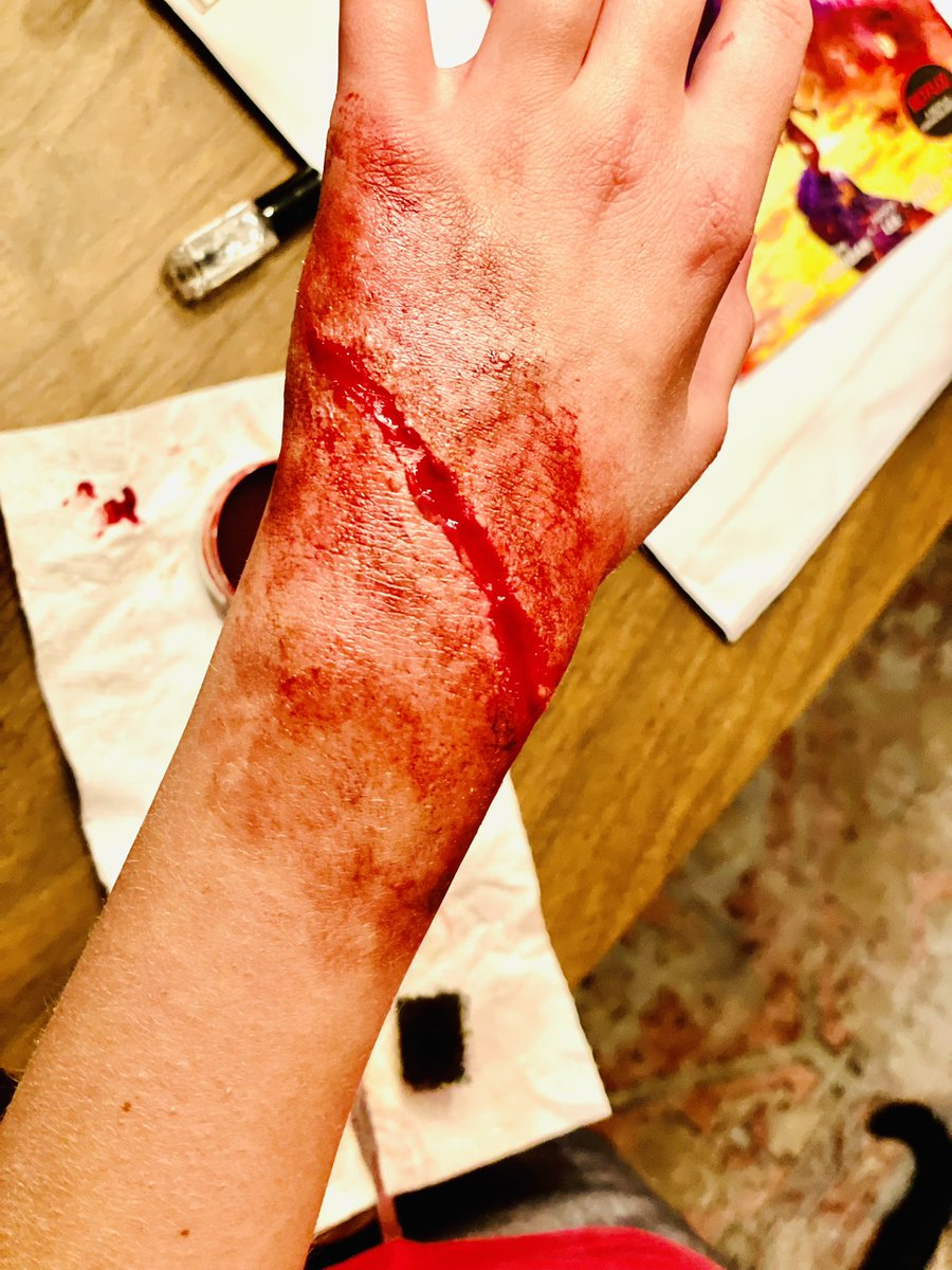 midwestfilmbuff's tweet image. Sweet! I started practicing cuts and wounds w/ a cheap Halloween makeup kit I found…
Effort 1: Epic fail. I blame the paint (no purple for bruising). But I digress.
Effort 2: I gave Piper a Giallo glass wound.
Effort 3: I gave Jude a hot poker wound.
I’m obsessed. #mutantfan
