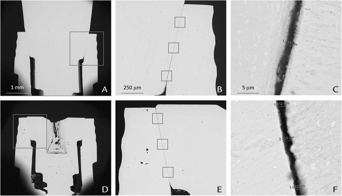 JPDentistry's tweet photo. Investigators  evaluate differences in #microgap and effectiveness of a sealing agent to reduce #bacterialleakage  around #healingabutments and #coverscrews. 

Learn more: https://t.co/SeooI8b1wz https://t.co/hoWCzbwAWX
