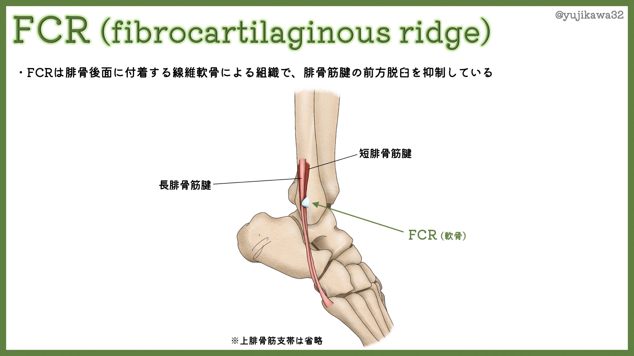 ユジカワ 整形dr イラストレーター 腓骨筋腱が前方脱臼しないように Fcrという線維軟骨性の組織がある 教科書で見るとエコーやmriの横断像はあるけど マクロの画像が中々ないので自分で書いてみた 実際に手術した時に見た通りに書いているので 万