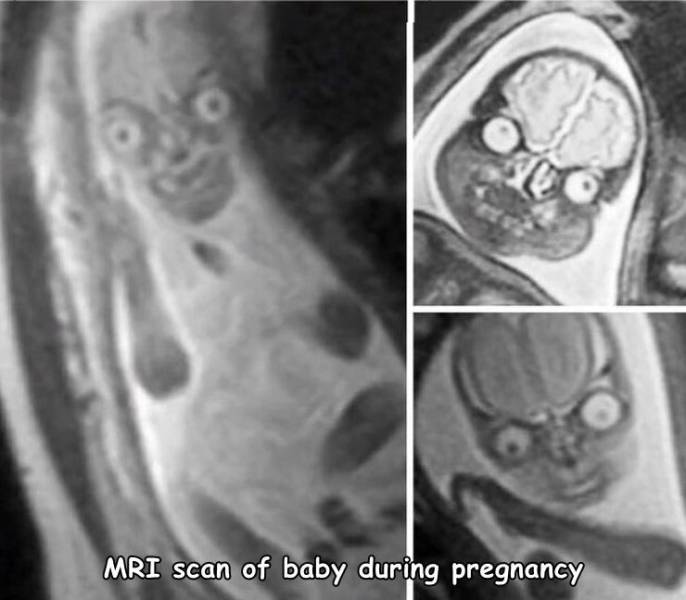 gnuman1979's tweet photo. Who's baby? https://t.co/zxTV8StQMp