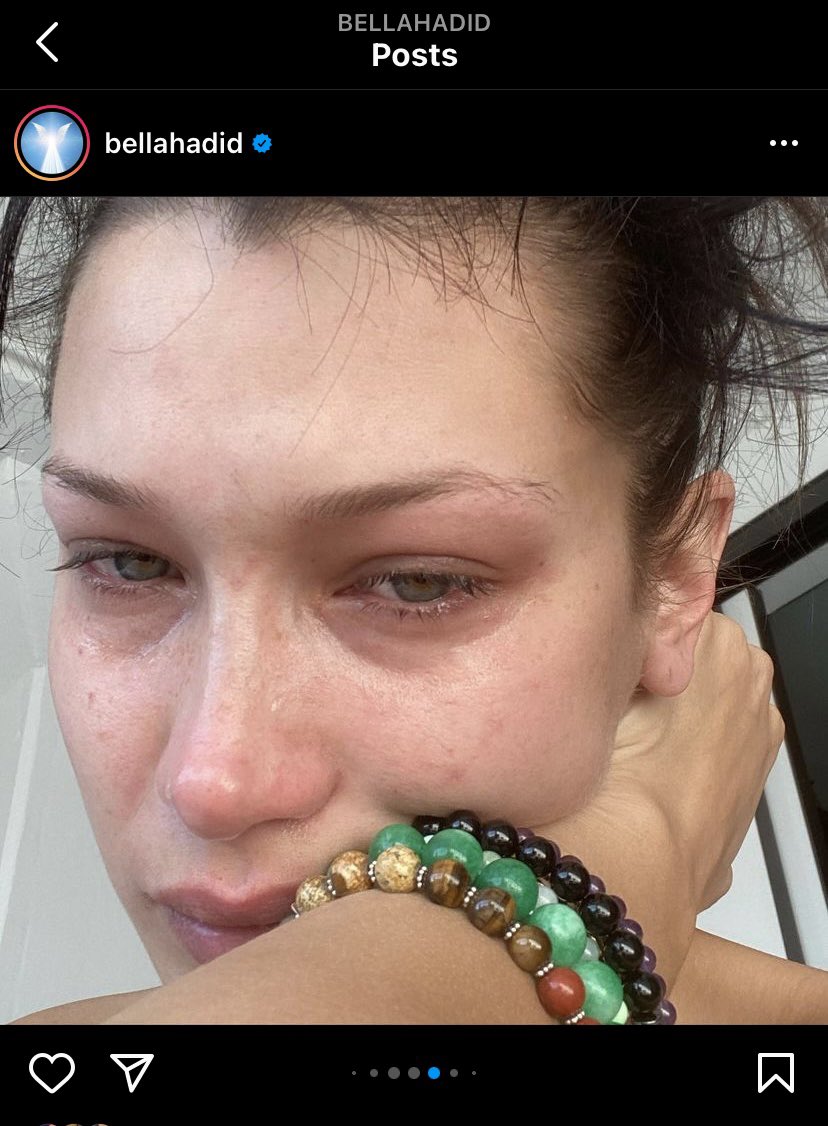 chroniCOM1600's tweet photo. Cette semaine, la mannequin Bella Hadid nous fait prendre conscience de l’importance de la santé mentale à travers plusieurs selfies, ce qui rentre dans le thème de la semaine ! #COM1600S08E https://t.co/OKBnLIAS2t