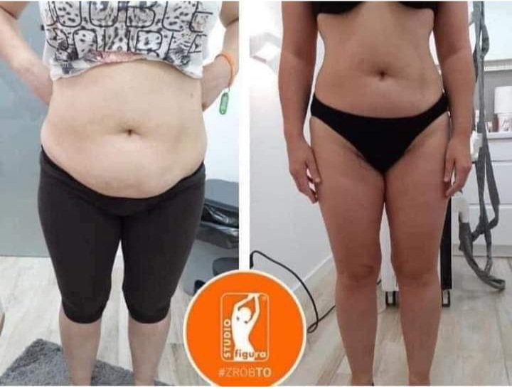 StudioFigLEIC's tweet photo. ➡️ Magda's stunning transformation!
👉🔥 9x Vacu Shaper
👉🔥 9x Roll Shaper
👉🔥 6x lymphatic drainage 
👉🔥12x Ultrasonic cavitation 
👉🔥 6x Endermology 
👊congratulations🧡
👉 Message us &amp; book your free consultation:
📲 07531 323458
#Leicester 
#studiofigura 
#beforeandafter https://t.co/EGCA1a0lRq