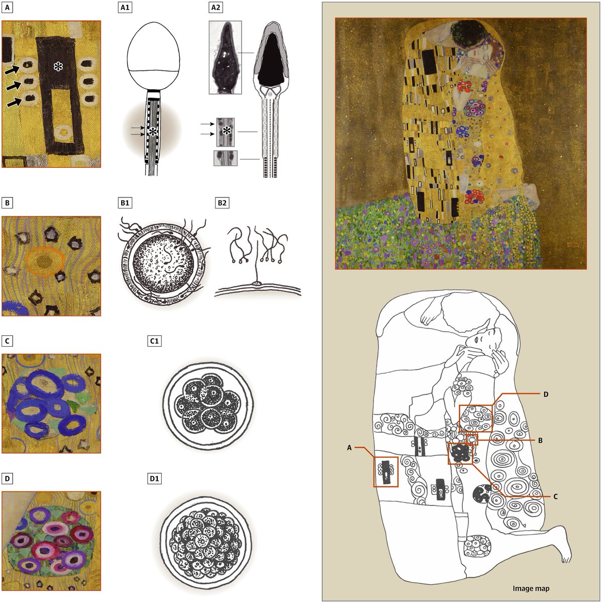 hyunmisurg's tweet photo. Gustav Klimt’s The Kiss—Art and the Biology of Early Human Development https://t.co/vGtr8FnADv via @JAMA_current part of @JAMANetwork So happy to have been part of this exciting project! https://t.co/irRGI40FBO