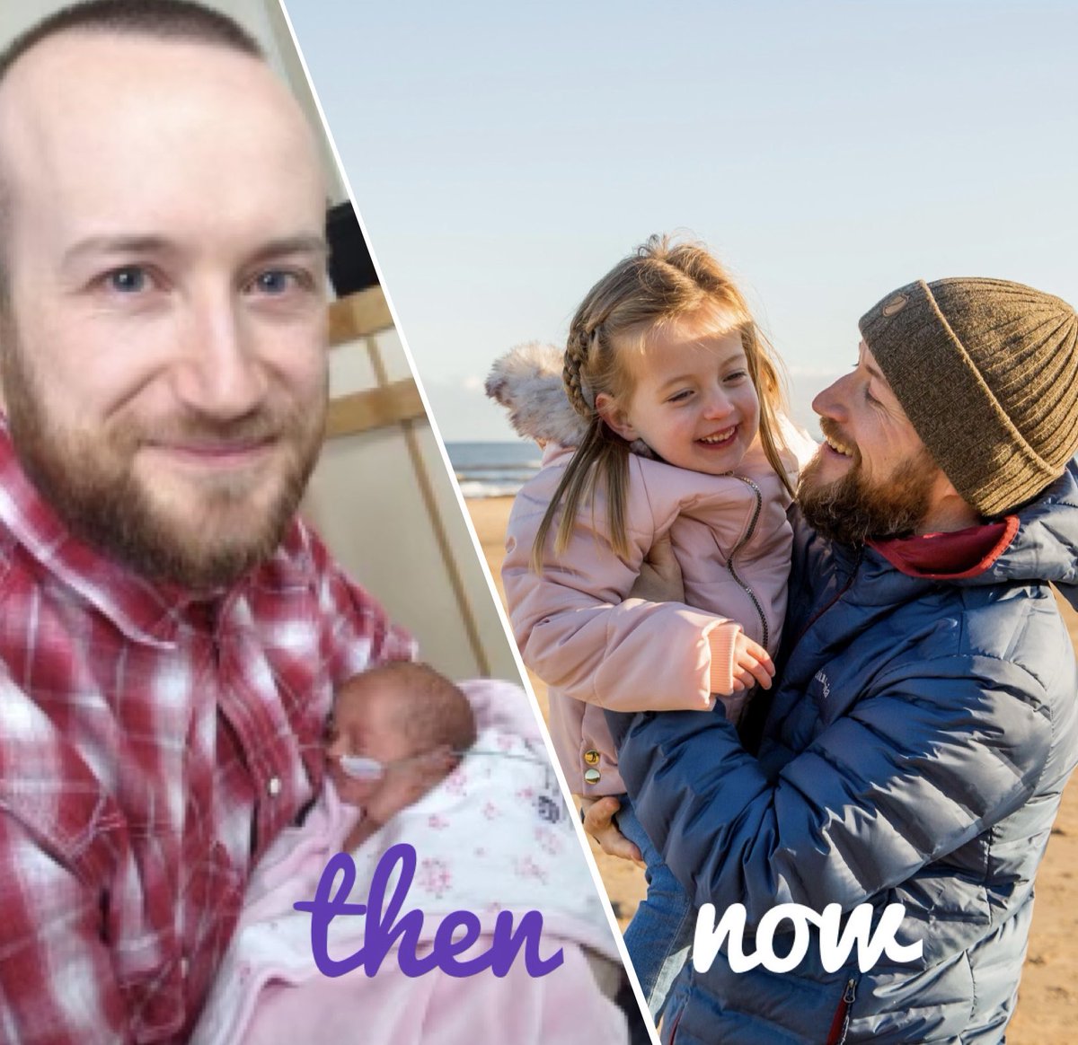 Here’s Dads Team member Steve with Phoebe, who was born in 2015 - a little wonder girl then and now! #worldprematurityday #preemiepower