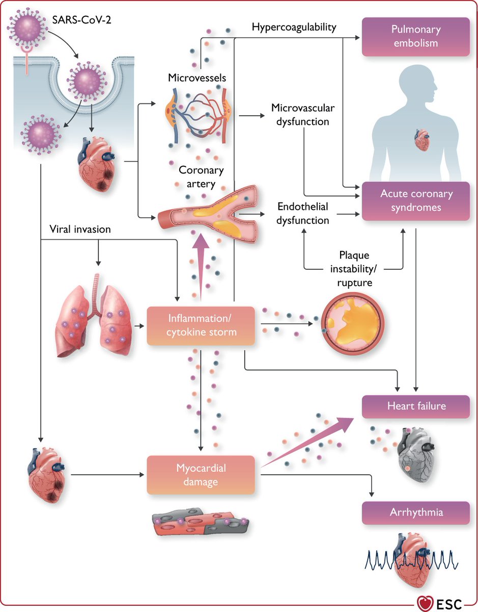 European Society of Cardiology (@escardio) on Twitter photo New: <a href="/escardio/">European Society of Cardiology</a> guidance for the diagnosis and management of #CardiovascularDisease during the #COVID19 pandemic: Part 1 – Epidemiology, pathophysiology and diagnosis academic.oup.com/eurheartj/adva…
#cardiotwitter #cardiology #ESCYoung #ESCSoT #heartteam #cvnurses #alliedprofessionals New: <a href="/escardio/">European Society of Cardiology</a> guidance for the diagnosis and management of #CardiovascularDisease during the #COVID19 pandemic: Part 1 – Epidemiology, pathophysiology and diagnosis academic.oup.com/eurheartj/adva…
#cardiotwitter #cardiology #ESCYoung #ESCSoT #heartteam #cvnurses #alliedprofessionals