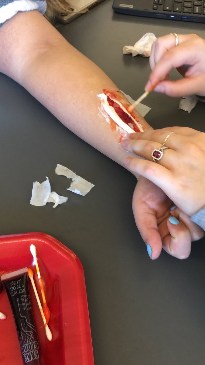 Toby Gibbons tweet media