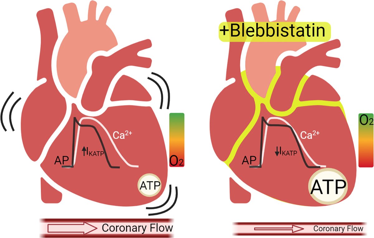 ajpheartcirc's tweet image. #GettingItRight by @NikkiPosnack  @RipplingerLab  @mwkaylab  @lswift70 reviews use of blebbistatin in cardiac #OpticalMapping, highlights secondary effects of the drug on cardiac electrical activity &amp;amp; metabolic demand, concludes with best practices ow.ly/LK9M50GOJcG