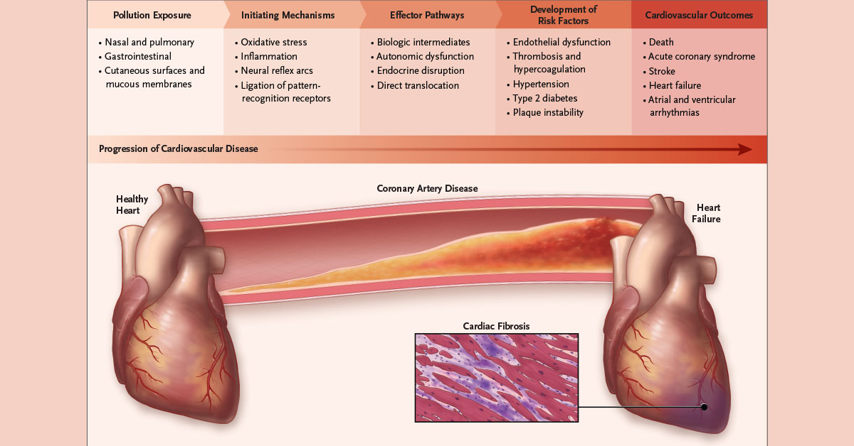 The Global Burden of Disease study estimated that pollution caused 9 million deaths in 2019; more than 60% were due to cardiovascular disease. Shifting to renewable energy sources may reduce such deaths. nej.md/30aQa7N