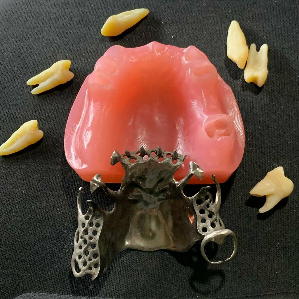 sakurapms's tweet image. I tried dental resin for #3dprint and #puretitanium #meshmixerdental