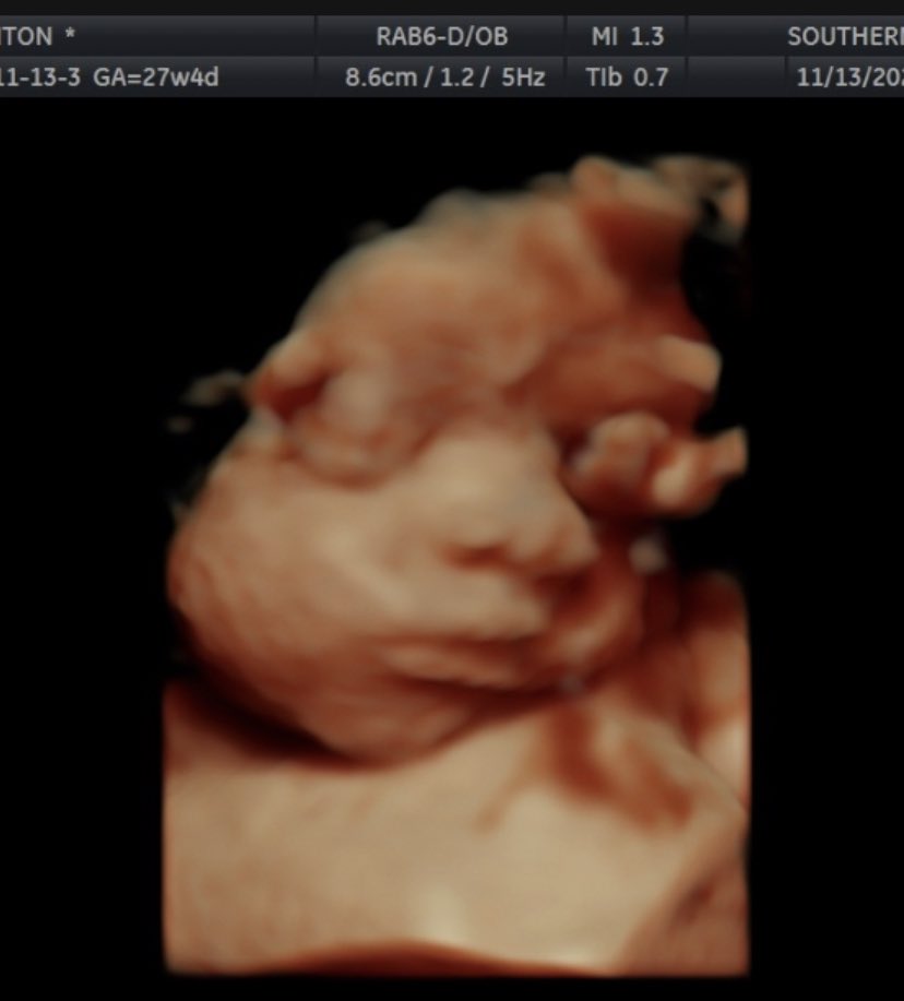 HaleyAshton12's tweet photo. Hello 3rd trimester!! We are so ready to get our baby boy here! This mama is obsessed. He is perfect💙🥺😍 https://t.co/76VoymV1VB