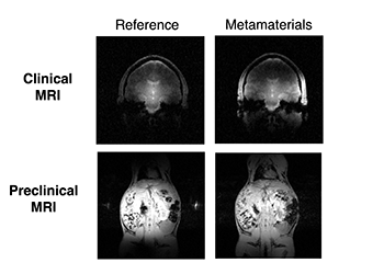 M_one_project's tweet photo. 🧐Want to know more about the adaptability of #metamaterials in different #MRI applications from preclinical to clinical studies at different magnetic fields ?
Follow @Tania_S_Vergara defense on-line tomorrow afternoon ! https://t.co/ShZON9WbcX