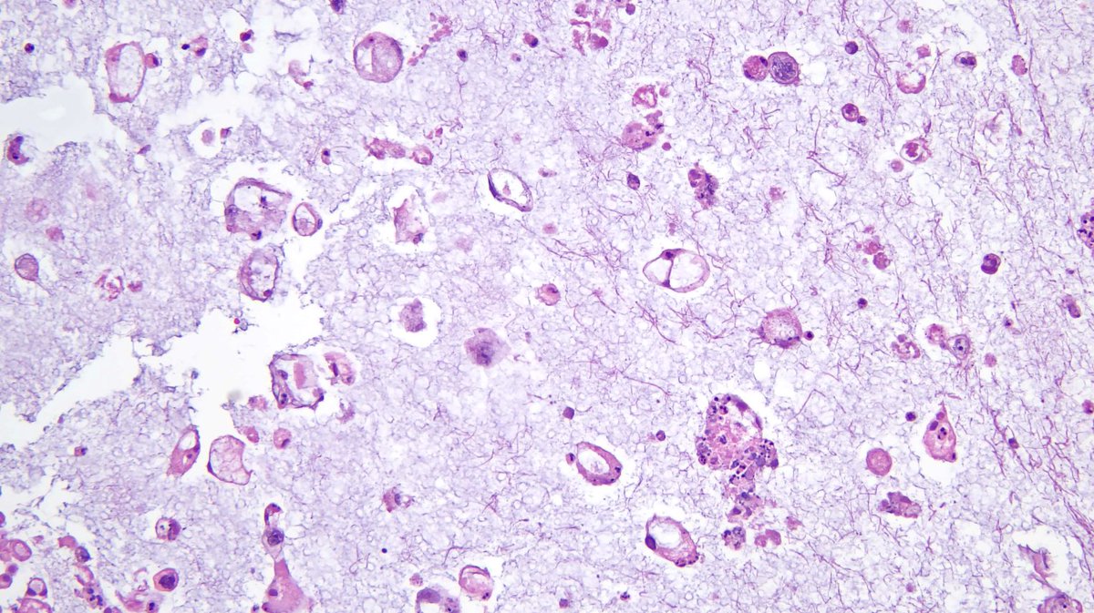 DavidSusterMD tweet media