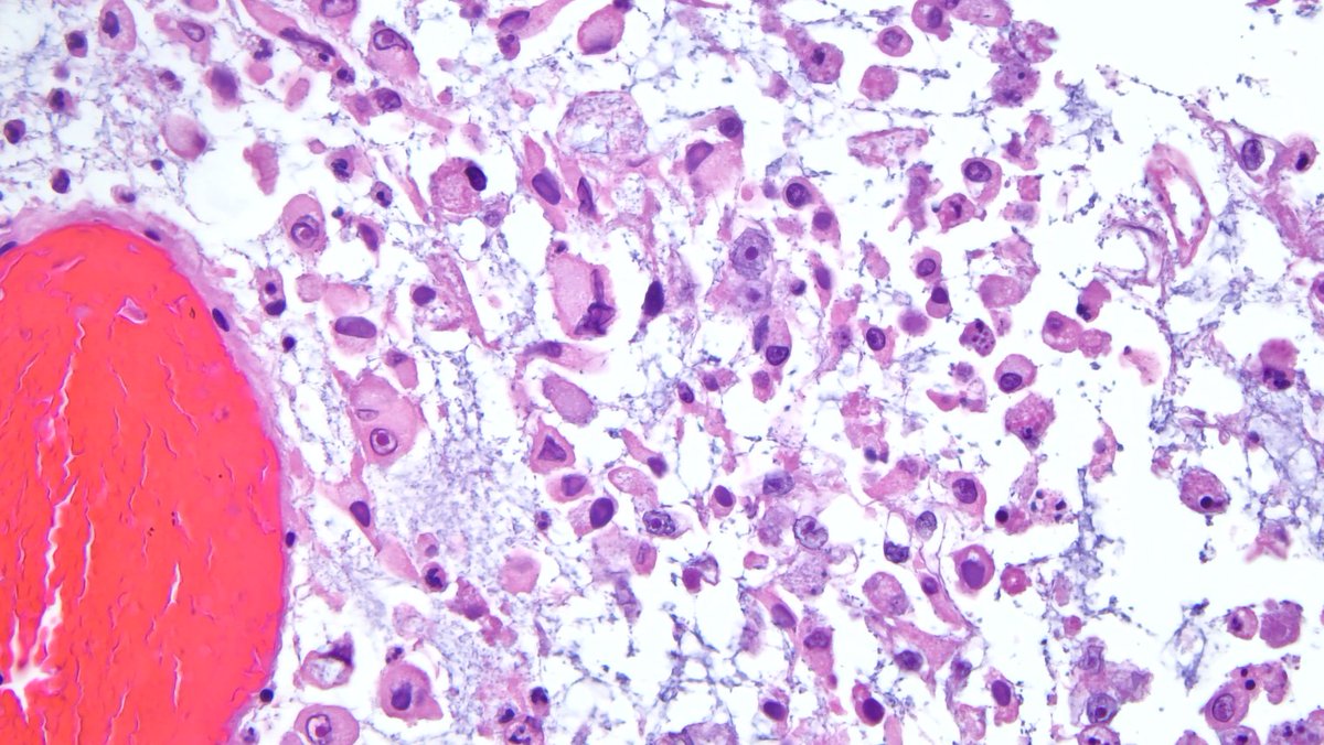 DavidSusterMD tweet media