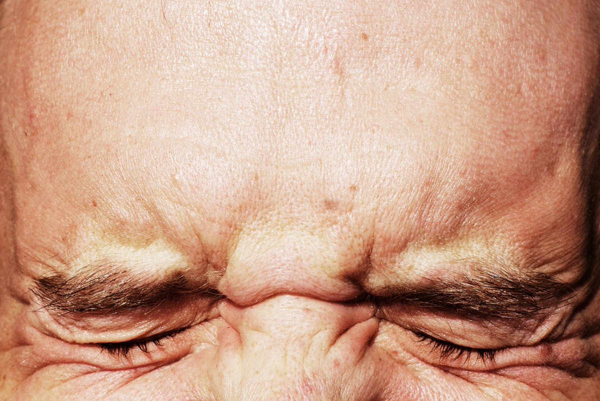 MutuelleMCCI's tweet photo. Irritations, démangeaisons, picotements, rougeurs, brûlures... vos yeux sont sujets à des symptômes multiples, mais assez similaires ...  Il est très important d'en identifier les causes pour vous soigner rapidement et retrouver un confort ocu https://t.co/lWxVd0fYoV https://t.co/WedsF8CD0f