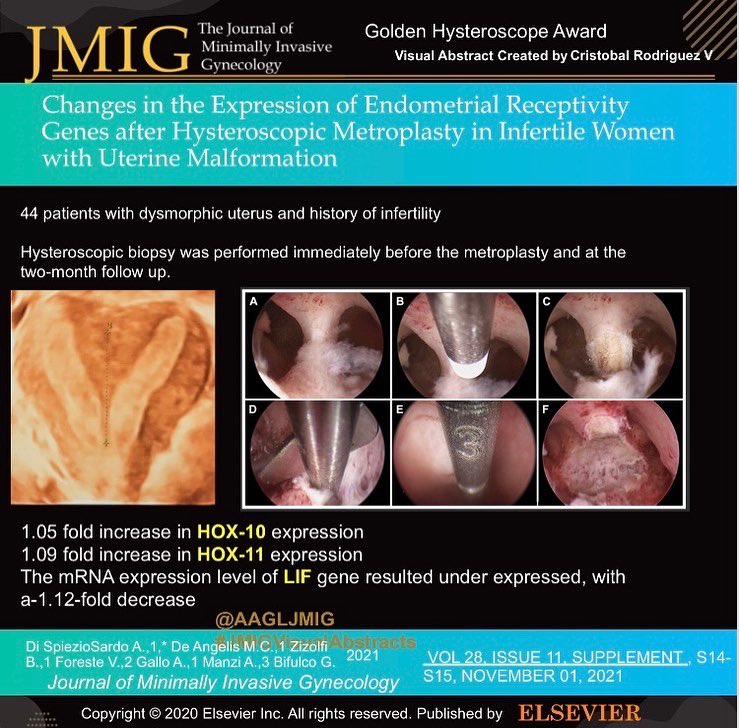 AAGLJMIG's tweet photo. #JMIGVisualAbstract celebrating award winning research, this year the Golden Hysteroscope  award for Best paper on Hysteroscopy goes to Dr Spiezo et al for Changes in the Expression of Endometrial Receptivity Genes after Hysteroscopic Metroplasty in Infertile Women @AAGL #AAGL21 https://t.co/dUPr0f7Tha