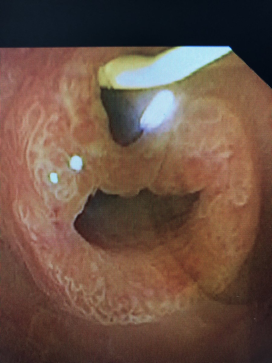 Cuando una CPRE te sonríe y te alegra el día 😂😂 <a href="/GVAhgandia/">DS Gandia</a> <a href="/Boborodada/">засохший</a> <a href="/Medicilio/">Dra. Elena Casado Pineda</a> <a href="/escapa79/">Vanesa M. Escapa</a> <a href="/inma_miral/">Inma Castello Miralles</a> <a href="/Belenmm271/">Belen Martinez Moreno</a> <a href="/martinfd78/">Martín #MFyC</a> <a href="/Tokioblues2/">Tokioblues</a> <a href="/alemany_gloria/">Gloria Alemany Perez</a> <a href="/ClarsPeiro/">Clara Navarro</a>