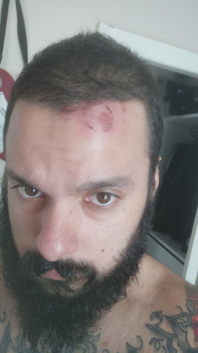 BadVibesMemes's tweet photo. @CamaradaHidalgo Ok! Vamos lá!
Nunca postei nenhuma dessas imagens  pois preferi resolver dentro das linhas da justiça, porém visto que quase dois anos depois do ocorrido continuam com campanhas de difamação e calúnia, segue: https://t.co/k1WJvjhSEF