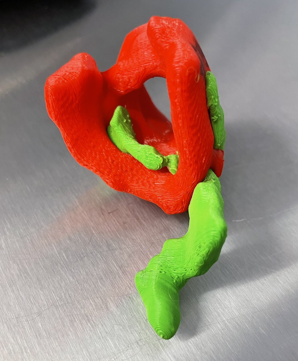 #3Dprinting in #fistula surgery. Still unsure if it’s a gimmick or a gamechanger…. <a href="/3DLab_ETZ/">ETZ In-Hospital 3D Lab</a> <a href="/Brouwers_3D/">Lars Brouwers, MD, PhD, MSc</a> #colorectalsurgery