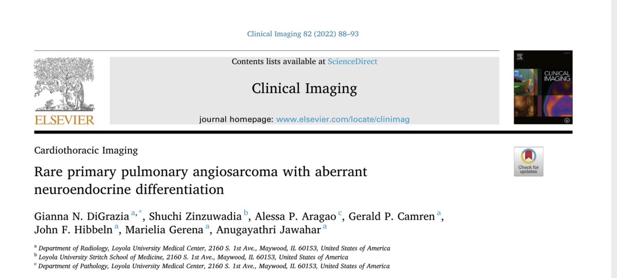 Shuchi Zinzuwadia, MD (@zinzuwadia_s) on Twitter photo Just off the press! Thank you <a href="/CI_Journal/">Clinical Imaging</a> for allowing us to publish our work. Take a look at this interesting case and I'd love to hear your thoughts. #RadTwitter #Match2022 <a href="/futureradres/">Future Radiology Residents</a>
sciencedirect.com/science/articl⦠Just off the press! Thank you <a href="/CI_Journal/">Clinical Imaging</a> for allowing us to publish our work. Take a look at this interesting case and I'd love to hear your thoughts. #RadTwitter #Match2022 <a href="/futureradres/">Future Radiology Residents</a>
sciencedirect.com/science/articlā¦