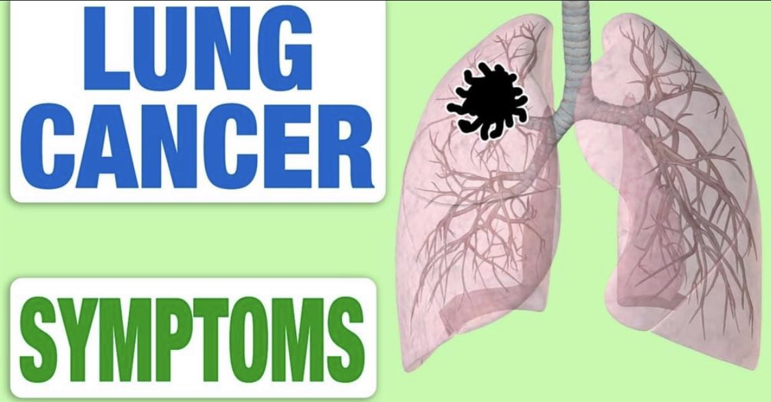 PatchaF's tweet photo. Lung cancer continues to be the number one cancer killer.
More about lung cancer symptoms here https://t.co/tmpQRg8HNw
November is Lung Cancer Awareness Month!
#fight4ZeroCancer #MMPF #CASEC #lungcancerawareness https://t.co/xumbt1MHtP