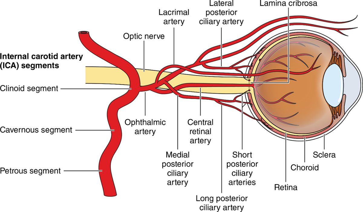 vascularnotes's tweet photo. CRAO! Scientific statement from @brianmacgrory and the @StrokeAHA_ASA
A medical emergency! Look for sudden, painless vision loss, rAPD, retinal hypoperfusion. 95% non-arteritic. Only ~50% of academic neurologists treat CRAO, we need more studies..
https://t.co/BBsaHn8K1e https://t.co/KkeNg69FVl