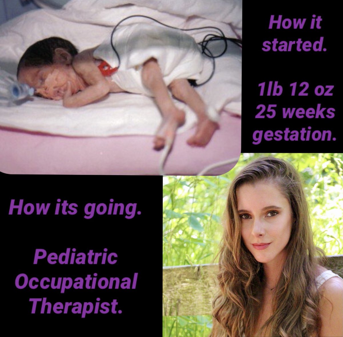 From 790grams to Pediatric OT @hamhealth Id say she has come full circle! #WorldPrematurityDay @Cdn_Prem_Babies #preemiepower @SinaiHealth