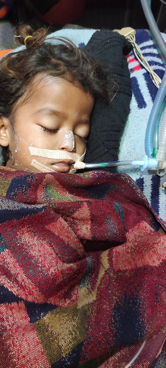 Sunil71420208's tweet photo. 🚨🚨🚨 *शीग्र अतिशीग्र इमरजेंसी मदद की गुहार 3 साल neumonia patient बच्चे को वेंटीलेटर बेड नहीं मिल रहा दिल्ली मे सफदरगंज हॉस्पिटल etc सब जगह मना कर रहे हैं* 🚨🚨🚨

@SatyendarJain
@msisodia
@ArvindKejriwal
@LtGovDelhi

तुरंत मदद करे जी
Sunil 9560131874 https://t.co/U7UcamZOYm