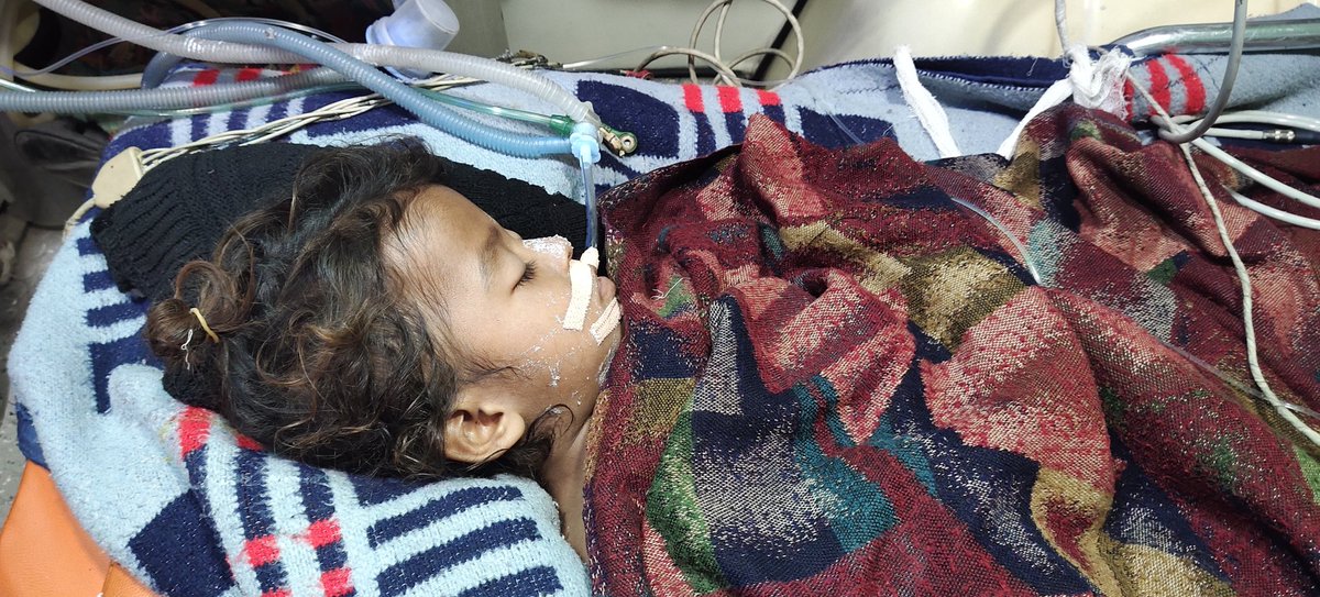 Sunil71420208's tweet photo. @ArvindKejriwal 🚨🚨🚨 *शीग्र अतिशीग्र इमरजेंसी मदद की गुहार 3 साल neumonia patient बच्चे को वेंटीलेटर बेड नहीं मिल रहा दिल्ली मे सफदरगंज हॉस्पिटल etc सब जगह मना कर रहे हैं* 🚨🚨🚨

@SatyendarJain
@msisodia
@ArvindKejriwal
@LtGovDelhi

तुरंत मदद करे जी
Sunil 9560131874
Please sir help 😭😰 https://t.co/qfA5Pbh5RE
