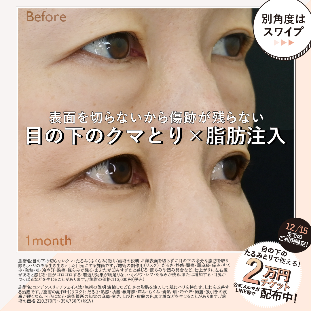 美容モニター Twitter Search Twitter