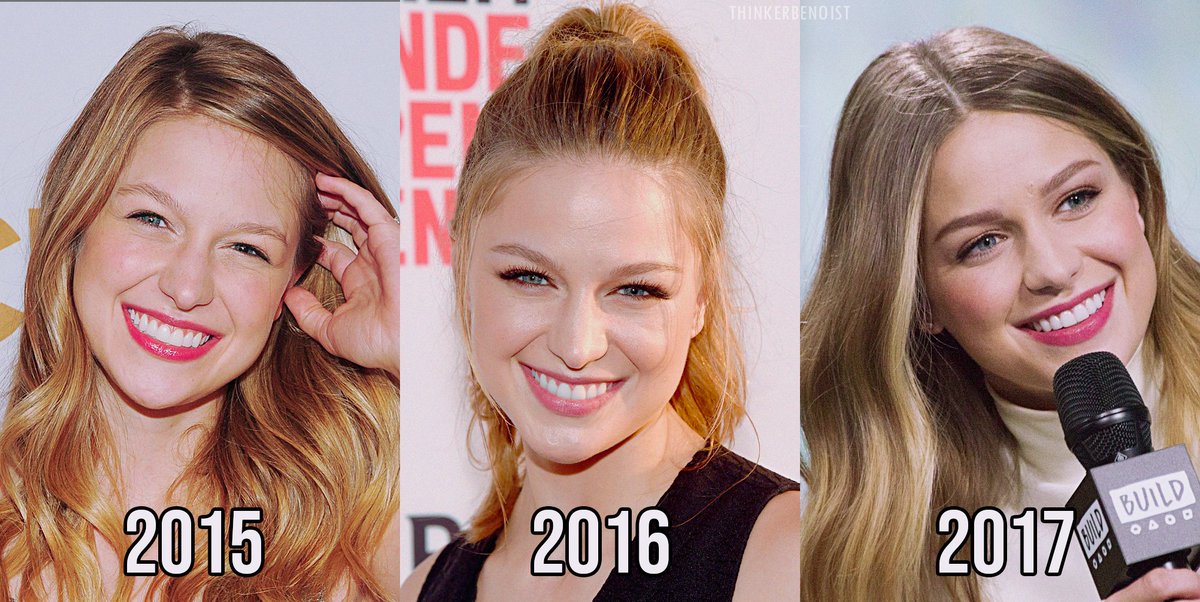 thinkerbenoist's tweet photo. the evolution of melissa benoist's prettiest smile throughout the years. you're welcome. 💭 https://t.co/trPd1Z7SDt