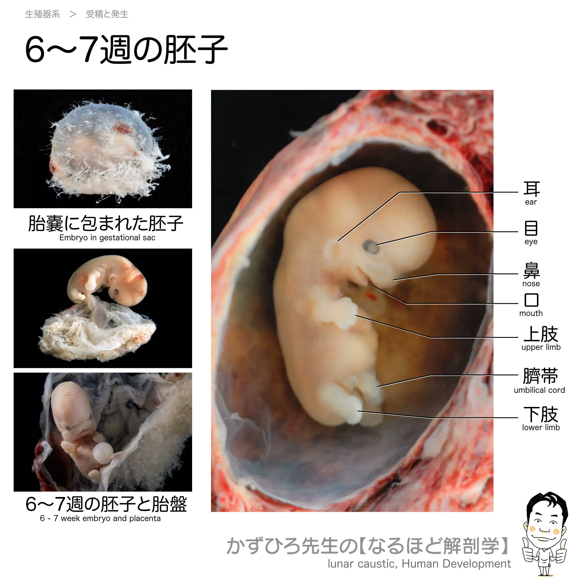 解剖学 深頸静脈 - e-Anatomy - IMAIOS