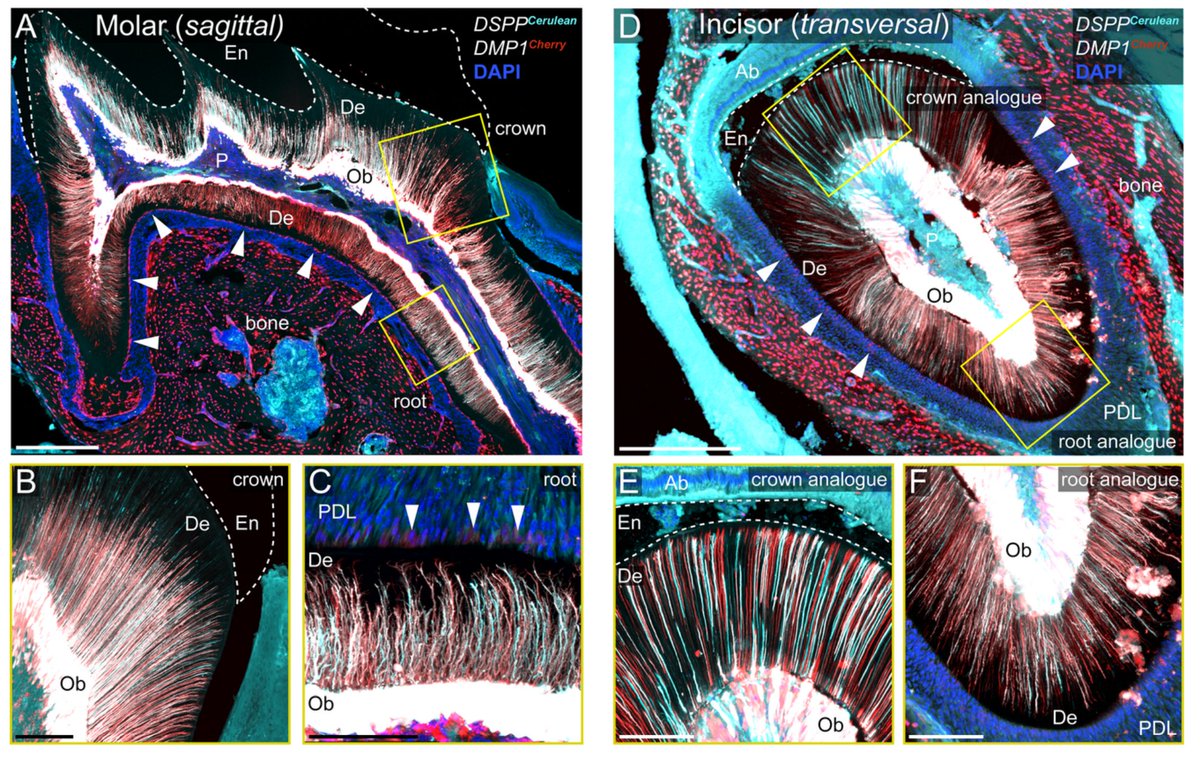 The development of dentin microstructure is controlled by the type of adjacent epithelium asbmr.onlinelibrary.wiley.com/doi/abs/10.100…