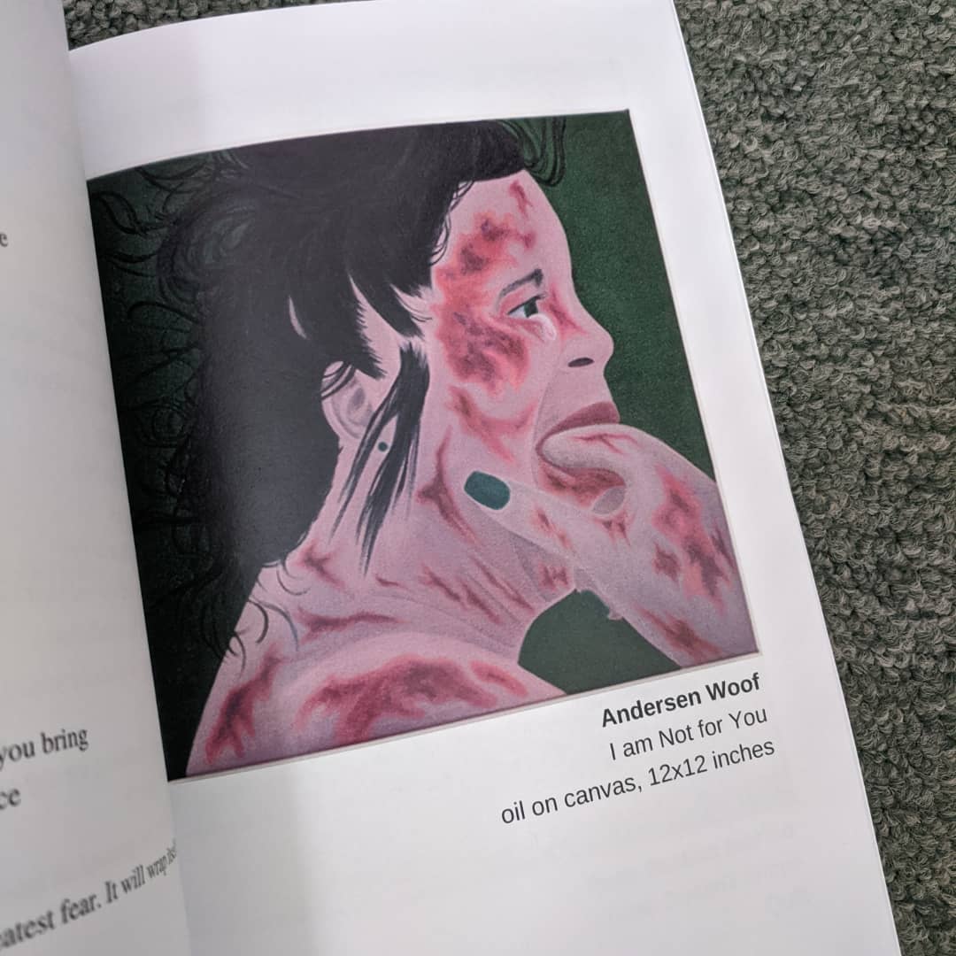 AndersenWoof's tweet photo. https://t.co/68OibGbOf9
Thank you so much @TurnAround_Inc for including three of my paintings from this year for the 12th Annual Purple Poetry Book!
For more book info, please visit
https://t.co/DTF76YxkoB
#bmoreart #bmoreartist #bruises #wounds #oilpaintings #tears #joyandpain https://t.co/6uym689n9t