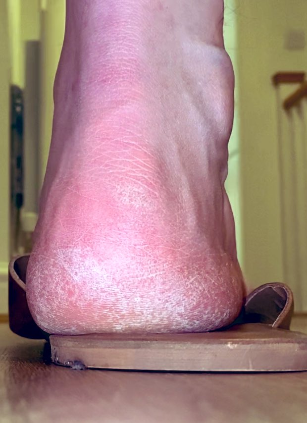 allthingscoolio's tweet photo. Find it sexy when a man can’t be bothered to wear his sandals properly and just has them hanging off and whilst sitting too.. careless, manly and hot #manly #gayfeet #malefeet #malefoot #calloused #roughfeet #soles #dudesfeet #ladsfeet #feetlove #manfeet #boyfeet #feetfetish https://t.co/9dPVZ18GT7