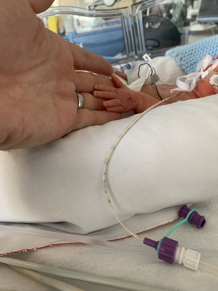 Today is #WorldPrematurityDay. As new parents with a premature baby born at 29 weeks in NICU right now, the positive stories and coverage today are a real boost for us. Ace is 6 weeks old (36 weeks) and already a little hero.