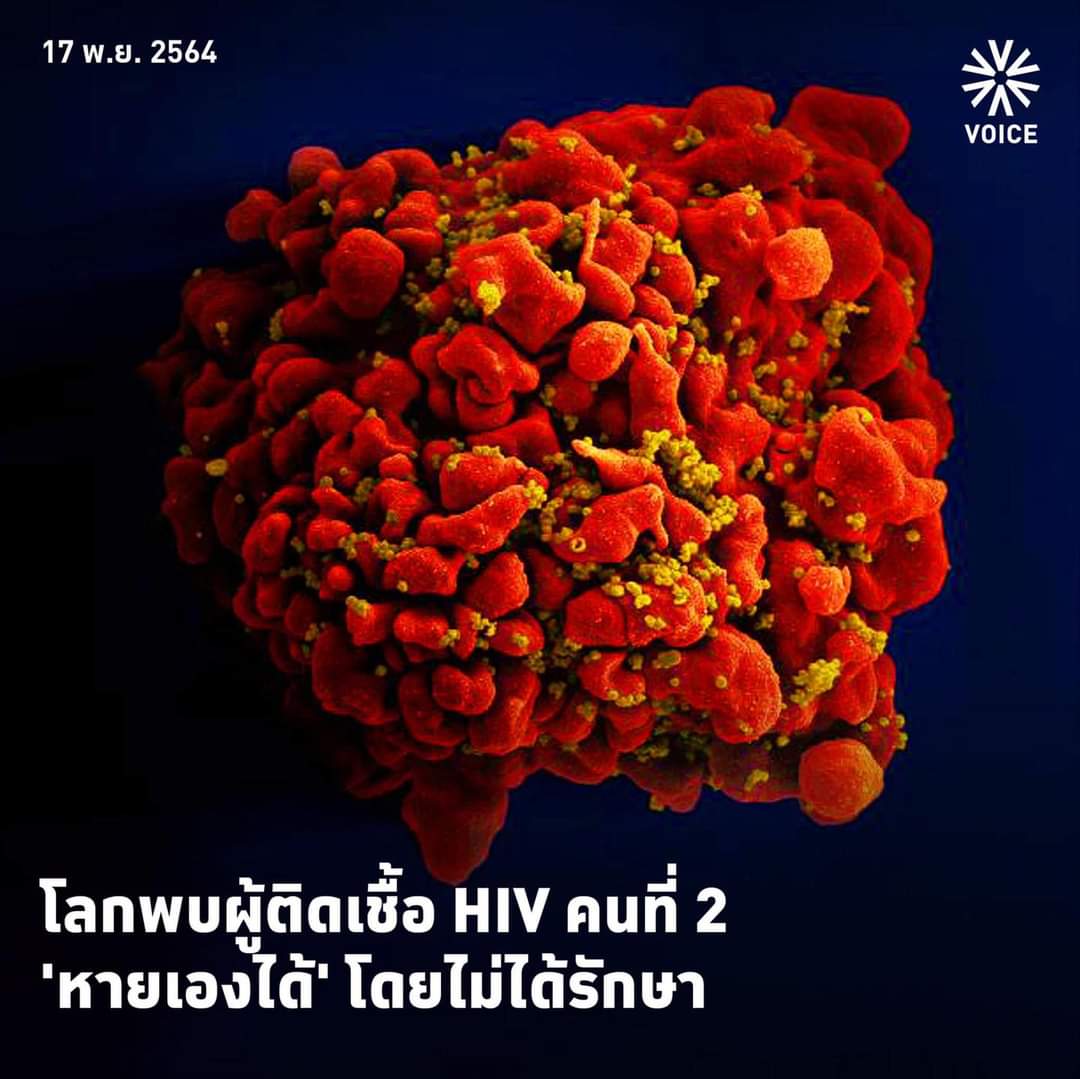 Gmbaby13's tweet photo. คนที่ 2 ของโลกที่หายได้เอง .. อยากให้ความโชคดีนี้เกิดขึ้นกับตัวเองบ้างจัง 🥺 https://t.co/YndKm8Jbox