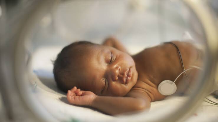 HealthSquareNG's tweet photo. There’s the myth of premature babies always turning out to be geniuses, but people hardly know the efforts put in place to ensure the baby’s survival as the chances are close to zero! 

Big shout to all preemie mums, doctors and nurses who worked hard to ensure survival. 💙👶🏾👶🏼👶🏻 https://t.co/WKnuZdBNss