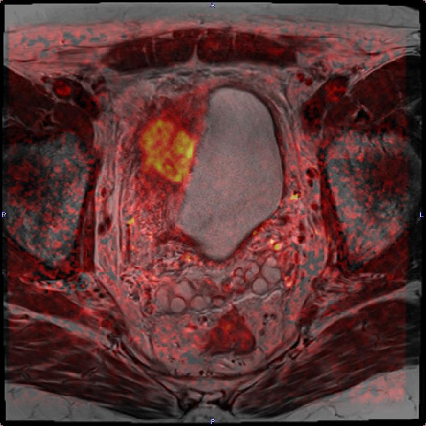 Radiologie USZ on Twitter "New MRI techniques may advance diagnostics