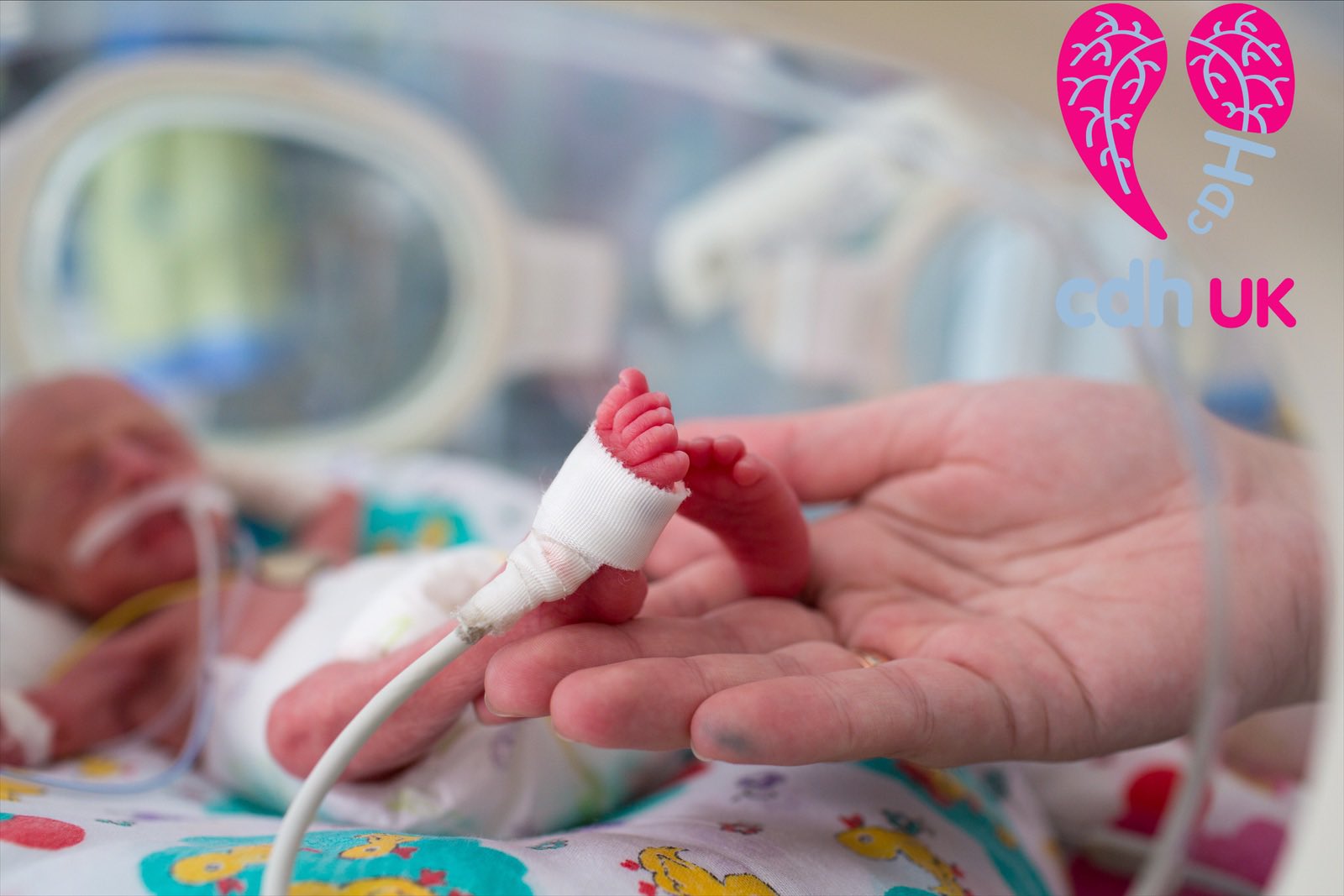 Cdh Uk Today Is Worldprematurityday And Many Of Our Families Have Experienced The Added Challenge Of A Baby Who Is Born Premature And With Cdh So Please Let S Help To
