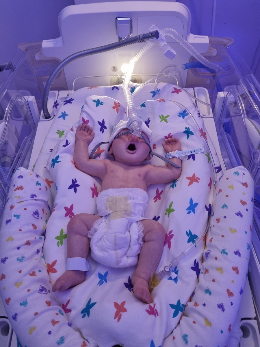 Wow! Incredible insight into the care needed in premature babies. @USWCareSciences @USW_ClinSimCent @Autumn42684725 #WorldPrematurityDay