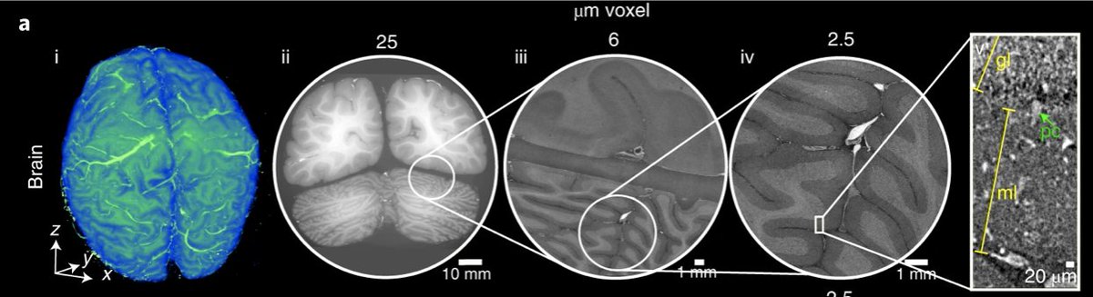 HVL_radiograf's tweet photo. Researchers at University College London produce amazing images of an intact human brain using hierarchial phase-contrast tomography #HiPCT #naturemethods #UniversityCollegeLondon
@naturemethods https://t.co/9cnA51JMec