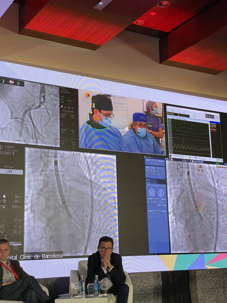 sbrugaletta's tweet photo. Excelente trabajo de todo staff médico/enfermería hemodinámica @hospitalclinic en #CSCurso sobre cómo optimizar implantación #TAVR #EVOLUTPro+ @AnderRegueiro @duelajara @atari_bcn @CapdetMontse @freixa_xavier #msabate special guest @ramirotrillo @CSC_interv https://t.co/DJFOBA3ZsN