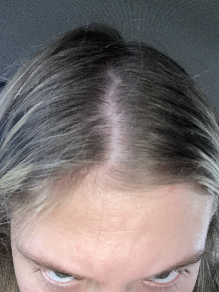 KalliValek's tweet photo. Not a picture of me trying to see how dark my roots are getting https://t.co/T4rguDUgOh